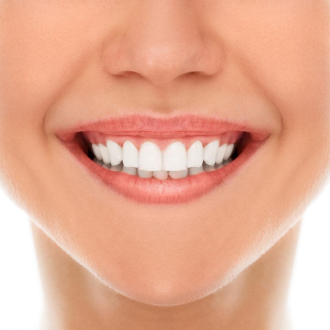 ORAL CARE
